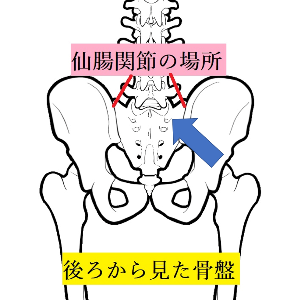 仙腸関節痛　大殿筋　収縮で骨盤を安定　分かりやすい図